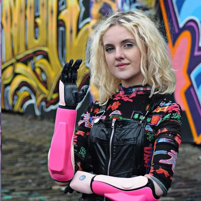 Woman wearing a pink Open Bionics prosthetic arm